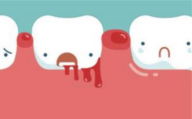 牙龈出血吃什么